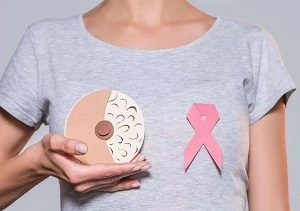 乳腺癌123.jpg