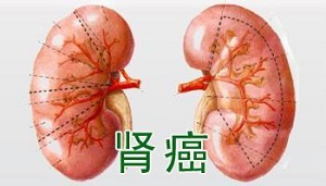 郑州治肿瘤的好中医: